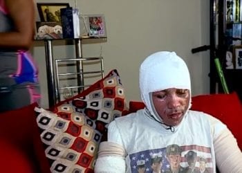 Nowe internetowe wyzwanie zbiera tragiczne żniwo. Hot Water Challenge coraz popularniejsze