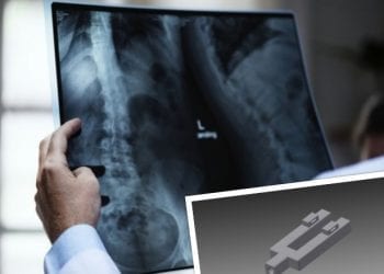 Ustnik pomoże wykryć nowotwory dróg oddechowych. To projekt naukowców Uniwersytetu Śląskiego