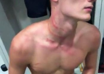 Brutalne zachowanie niemieckiego piłkarza wobec Francuza. Korkami poorał mu… szyję. Kuriozalna decyzja sędziego [WIDEO]