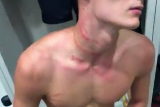 Brutalne zachowanie niemieckiego piłkarza wobec Francuza. Korkami poorał mu… szyję. Kuriozalna decyzja sędziego [WIDEO]