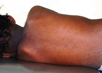 Odra coraz poważniejszym zagrożeniem w Polsce. Problem napłynął do nas z Ukrainy?