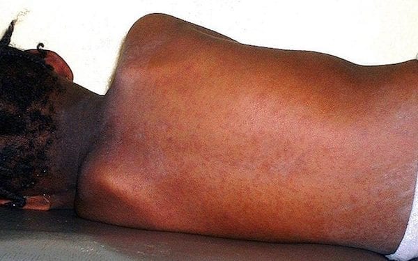 Odra coraz poważniejszym zagrożeniem w Polsce. Problem napłynął do nas z Ukrainy?