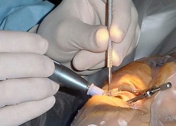 Chiny: W kostnicy kradli gałki oczne. Już zostali aresztowani. „To zbyt makabryczne”