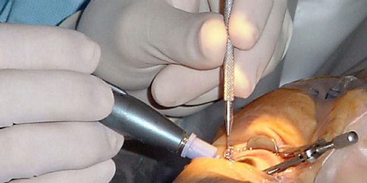 Chiny: W kostnicy kradli gałki oczne. Już zostali aresztowani. „To zbyt makabryczne”