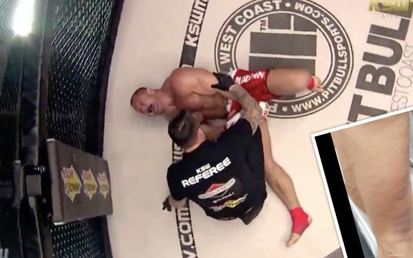 Pudzianowski pokazał zdjęcie nogi po walce