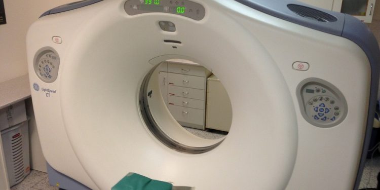 Dynamicznie wzrasta zachorowalność na nowotwory głowy i szyi