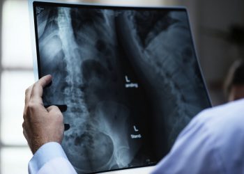lekarz szpital badanie prześwietlenie rtg
