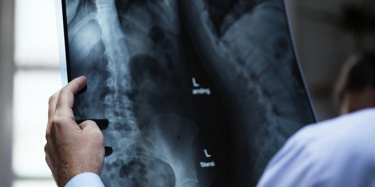 lekarz szpital badanie prześwietlenie rtg