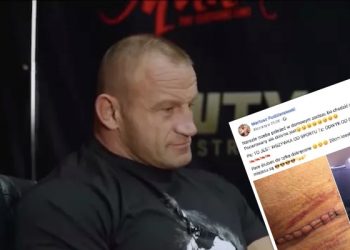 Pudzianowski pokazał zdjęcie nogi po operacji