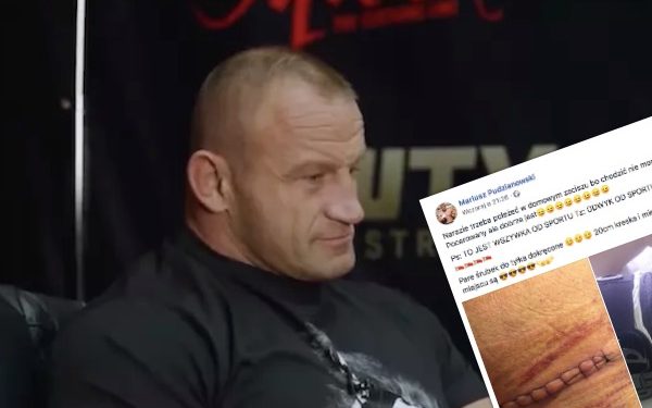 Pudzianowski pokazał zdjęcie nogi po operacji