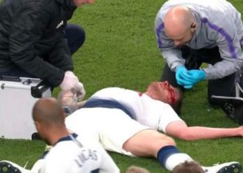 Liga Mistrzów. Jan Vertonghen opuścił boisko. Piłkarz był zalany krwią