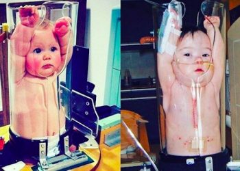 Zaskakująca metoda badania dzieci. Te zdjęcia robią furorę!