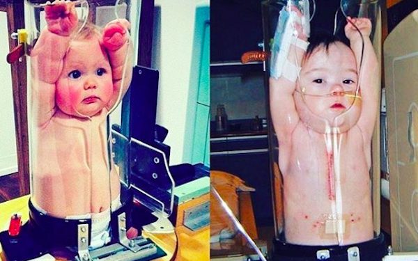 Zaskakująca metoda badania dzieci. Te zdjęcia robią furorę!