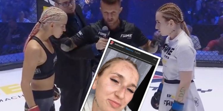 „Linkimaster” pokazała twarz dzień po walce