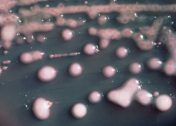 Śmiertelna superbakteria rozprzestrzenia się w Polsce. Potwierdzono ponad 3 tys. przypadków!