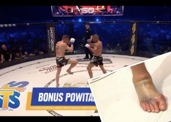 Potworna kontuzja stopy Polaka podczas KSW 50. Zdjęcie trafiło do sieci [FOTO+WIDEO]