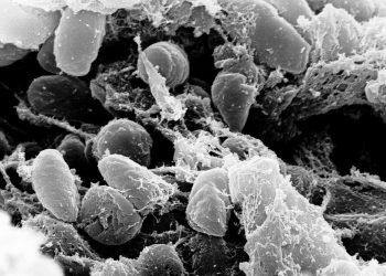 „Czarna śmierć” powraca? Kolejny przypadek, rośnie obawa przed epidemią