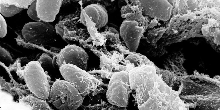 „Czarna śmierć” powraca? Kolejny przypadek, rośnie obawa przed epidemią