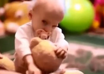 8-latka zmarła ze… starości. To najmłodszy taki przypadek na świecie [WIDEO]