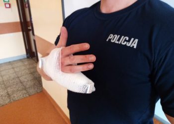 Poznań: Odgryzł palec policjantowi! Dopadli go po pościgu
