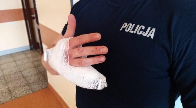 Poznań: Odgryzł palec policjantowi! Dopadli go po pościgu