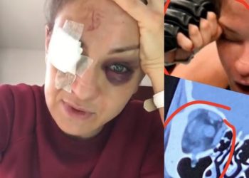 kowalkiewicz kontuzja