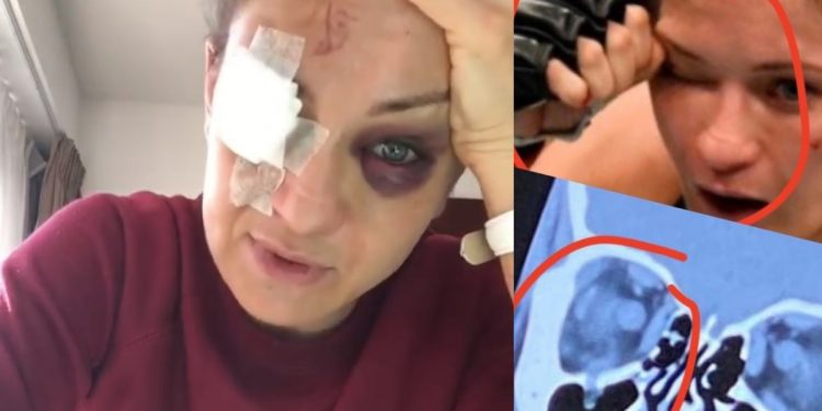 kowalkiewicz kontuzja