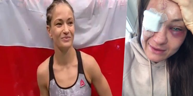 kowalkiewicz po walce