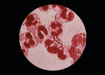 Zapomniane choroby powracają. Ogromny wzrost zakażeń kiłą i rzeżączką