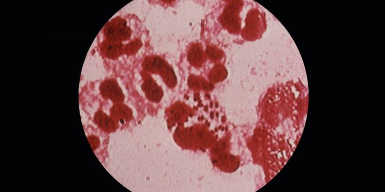 Zapomniane choroby powracają. Ogromny wzrost zakażeń kiłą i rzeżączką