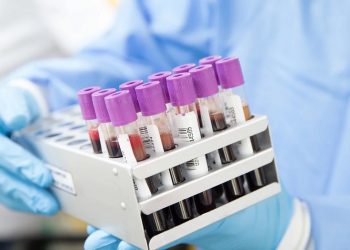 próbówki testy labratorium