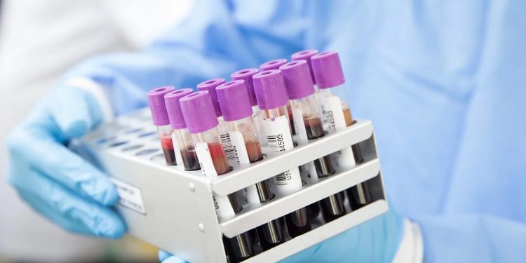 próbówki testy labratorium