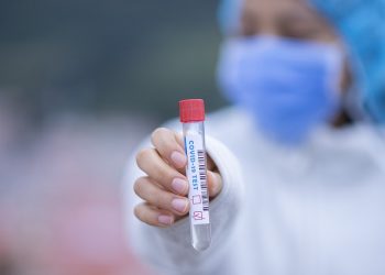 test koronawirus