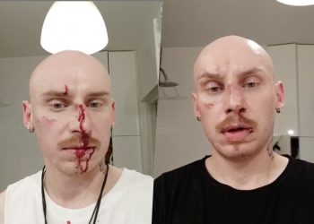 Uczestnik „Googlebox” i były fryzjer Andrzeja Dudy pobity! Wydał oświadczenie [WIDEO]