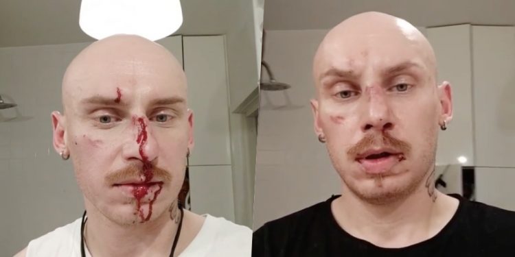 Uczestnik „Googlebox” i były fryzjer Andrzeja Dudy pobity! Wydał oświadczenie [WIDEO]