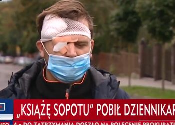 Operator TVP pobity! Dramatyczna relacja: „Wyszedł syn zatrzymanego” [WIDEO]