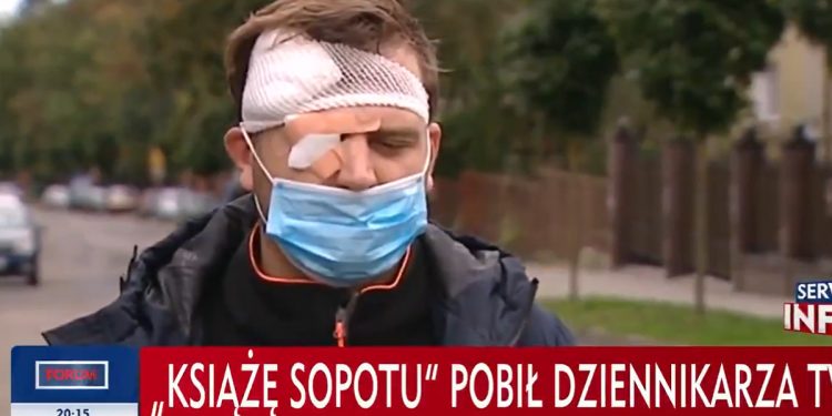 Operator TVP pobity! Dramatyczna relacja: „Wyszedł syn zatrzymanego” [WIDEO]