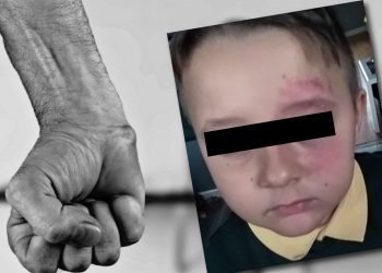 7-letni Gabryś został pobity