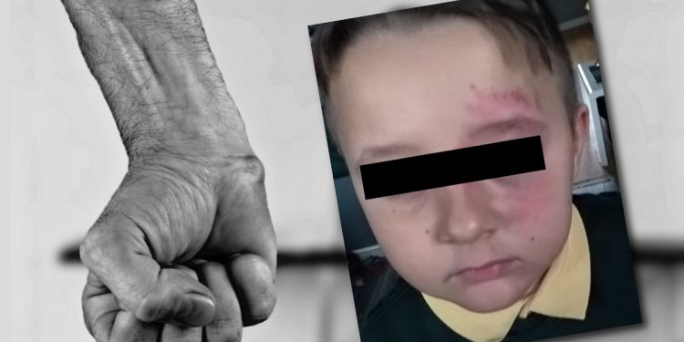 7-letni Gabryś został pobity