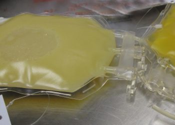 Zaskakujące wyniki badań. Osocze ozdrowieńców nie wpływa na leczenie chorych z COVID-19?