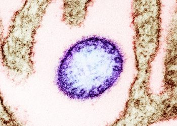 Kolejny groźny wirus z Chin. Atakuje mózg i zabija nawet 75 procent zakażonych