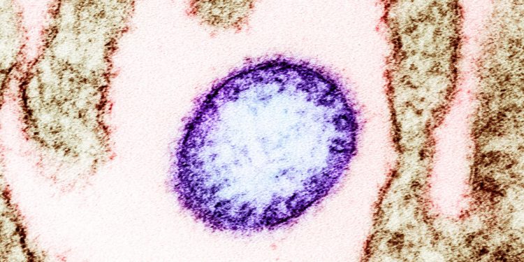 Kolejny groźny wirus z Chin. Atakuje mózg i zabija nawet 75 procent zakażonych