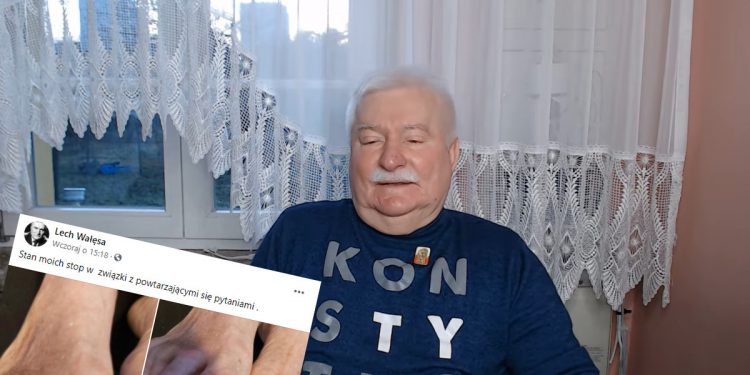 Wałęsa pokazał w sieci swoje stopy. Są w szokującym stanie [FOTO]