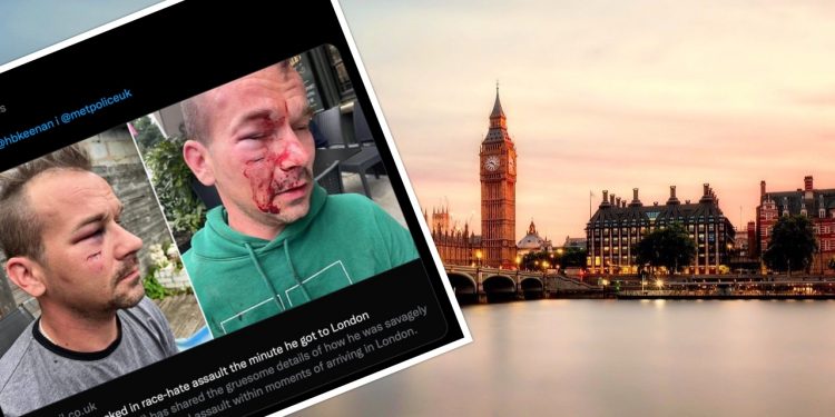 Polak brutalnie pobity w Londynie. Wcześniej napastnicy zapytali go, skąd pochodzi [WIDEO]