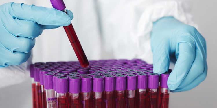 Znaczenie morfologii krwi w diagnostyce anemii