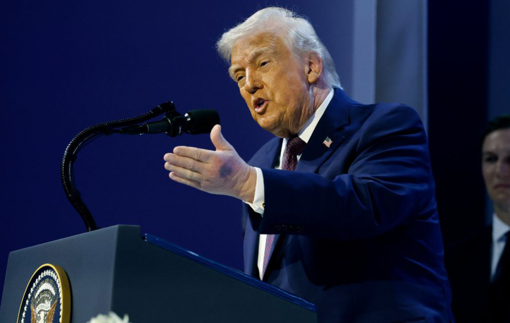 Cały świat zwrócił uwagę na ręce Trumpa. Prezydent USA tłumaczy, co się dzieje